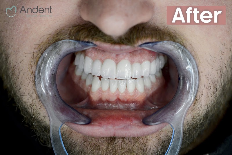 Confident smile, real results